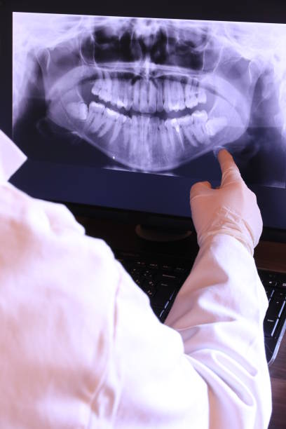 Best Emergency Care for Gum Disease in White Hall, IL