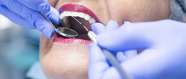 Best Emergency Treatment for Oral Infections in White Hall, IL
